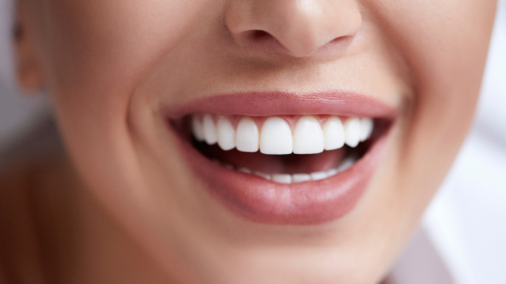 Zęby po piaskowaniu to blask, błysk i zdrowy wygląd