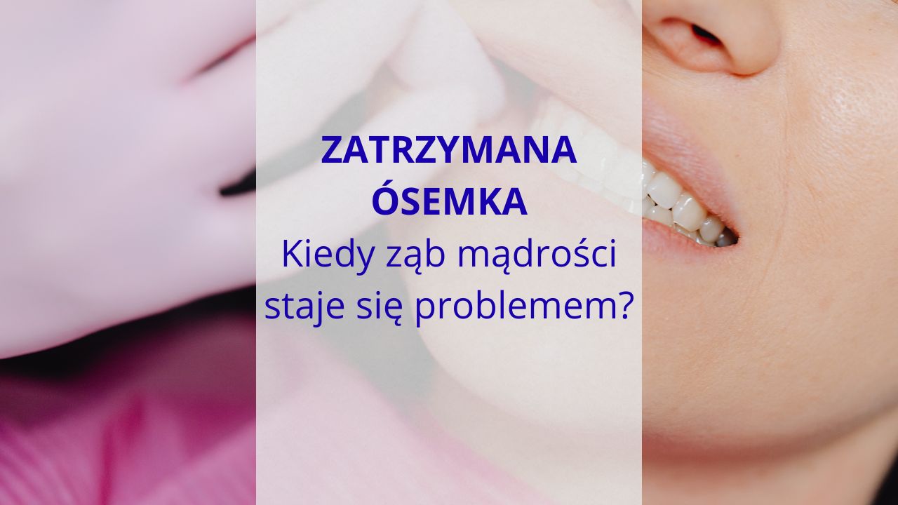 Zatrzymana ósemka - kiedy ząb mądrości staje się problemem? - DentoMED ...